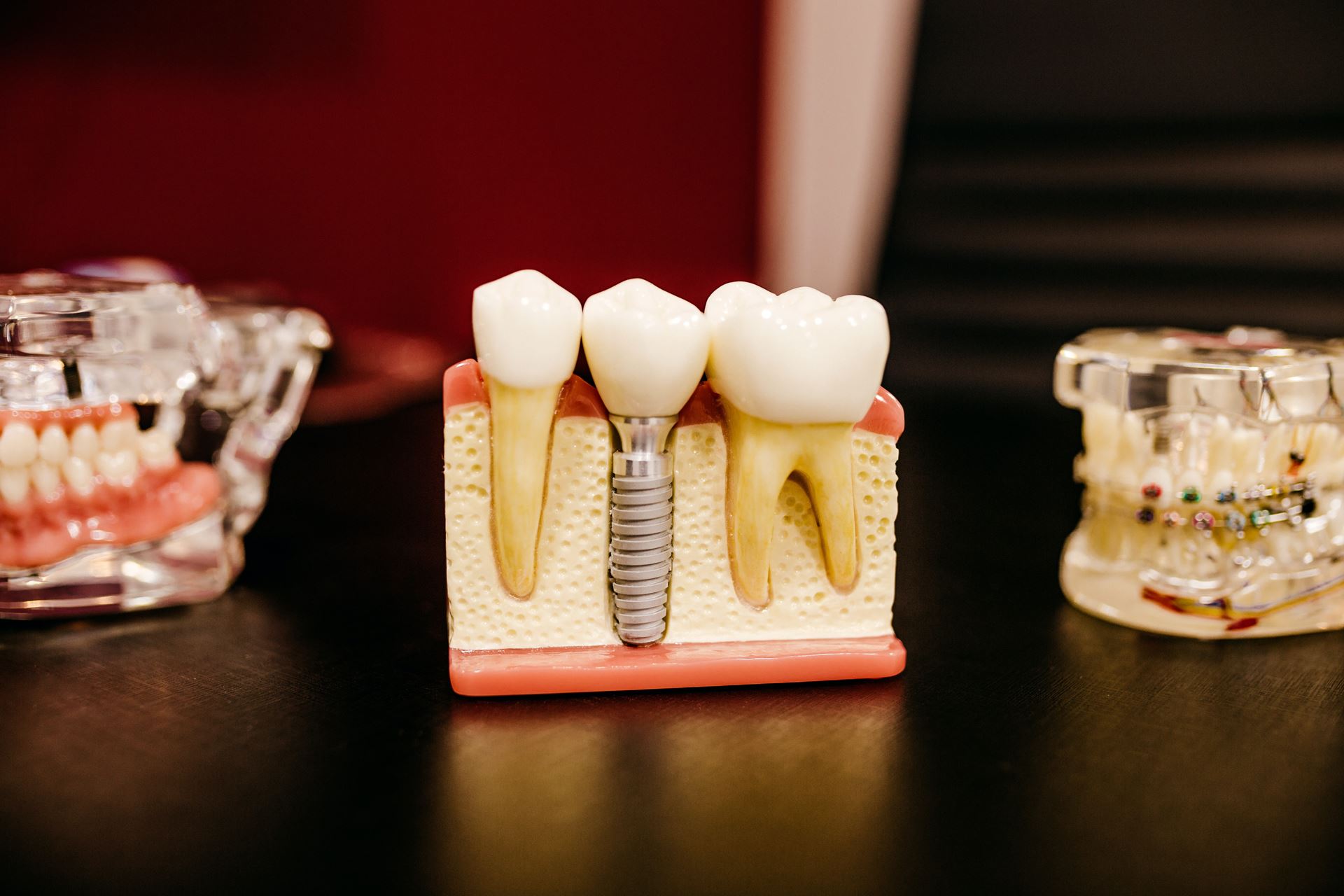 Teeth and dental work